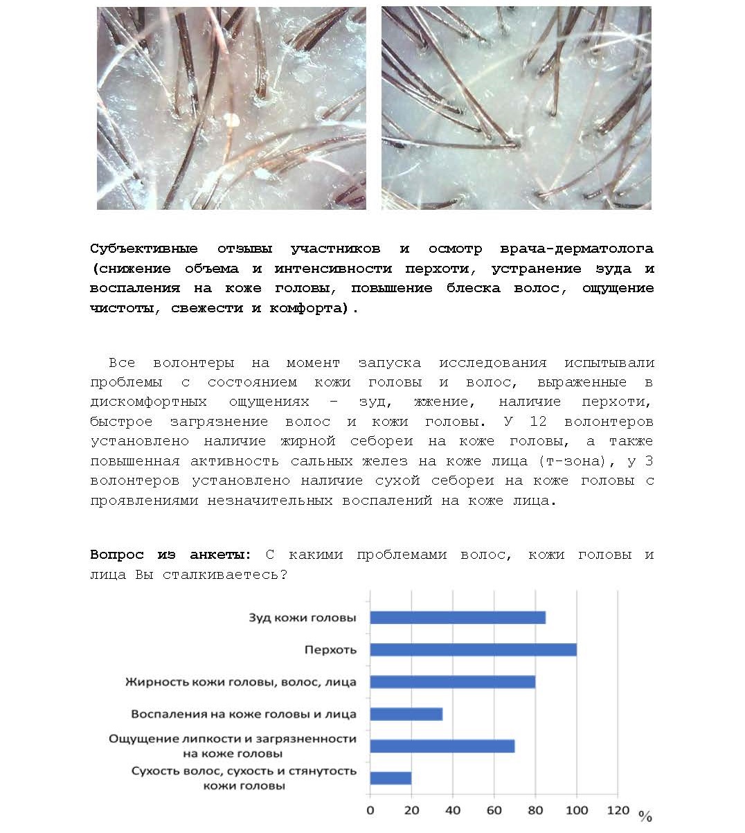 Купить Шампунь-Защита от перхоти 200 мл. Для волос и кожи всех типов